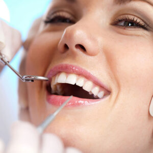 cosmetic crowns